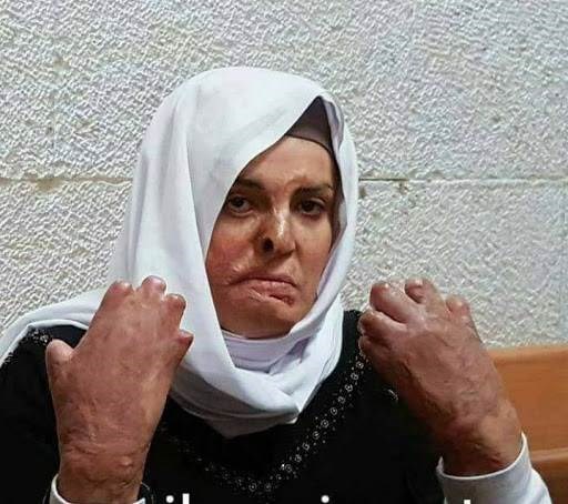 نضال المرأة: رفض الاحتلال إجراء عملية للأسيرة جعابيص تشريع لسياسة القتل البطيء