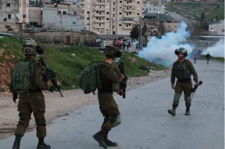 إصابة مواطن برصاص قوات الاحتلال في بلدة الرام