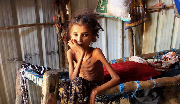 التلغراف:  اليمن على شفا أكبر مجاعة في التاريخ