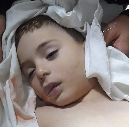 مصرع طفل سقط من علو في أحد المنتجعات بغزة