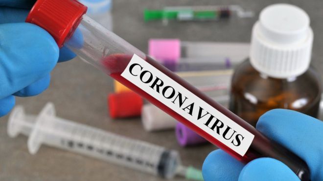 الصحة: 13 وفاة و2545 إصابة جديدة بفيروس كورونا و5216 حالة تعاف