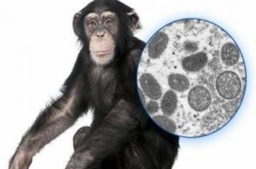 الصحة الإسرائيلية تنفي وجود إصابات جديدة بجدري القرود