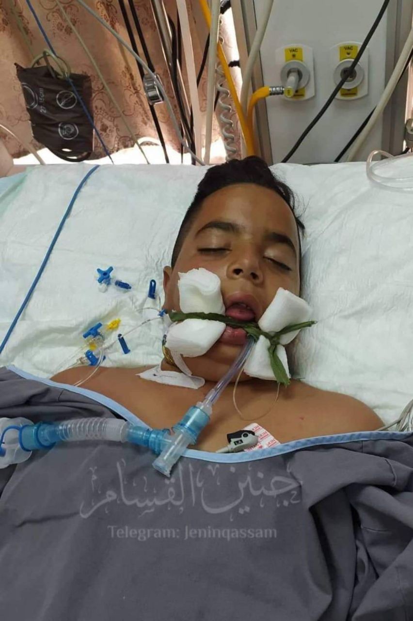 استشهاد الطفل محمود سمودي متأثرا بإصابته برصاص الاحتلال في جنين